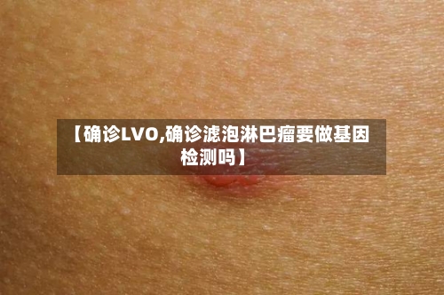 【确诊LVO,确诊滤泡淋巴瘤要做基因检测吗】