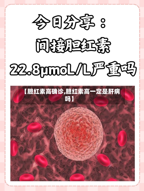 【胆红素高确诊,胆红素高一定是肝病吗】