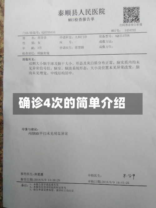 确诊4次的简单介绍