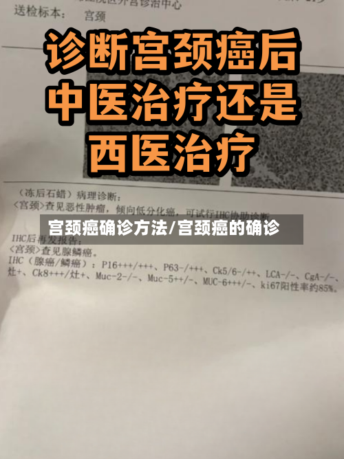 宫颈癌确诊方法/宫颈癌的确诊