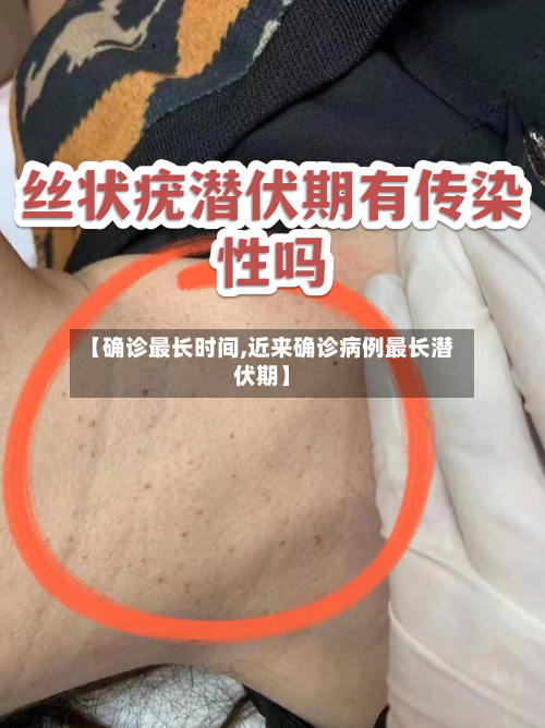 【确诊最长时间,近来确诊病例最长潜伏期】