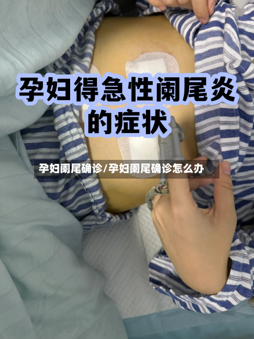 孕妇阑尾确诊/孕妇阑尾确诊怎么办
