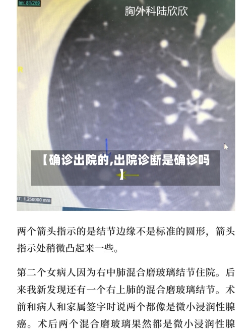 【确诊出院的,出院诊断是确诊吗】