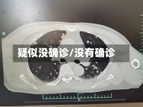 疑似没确诊/没有确诊
