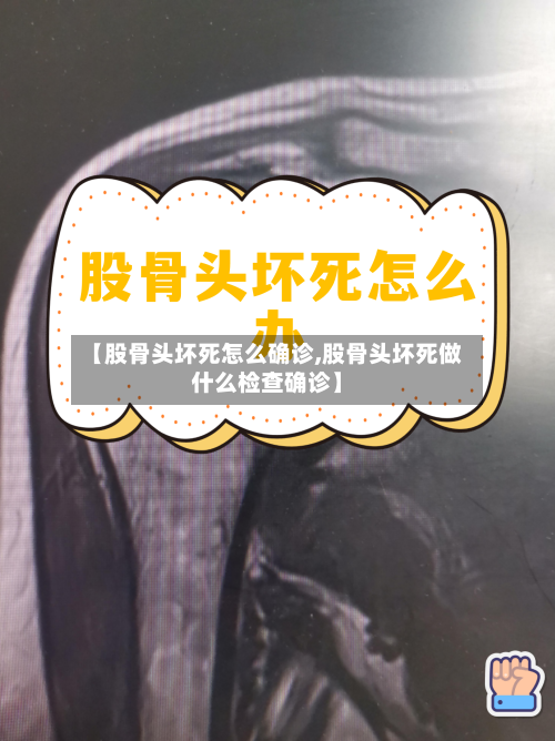 【股骨头坏死怎么确诊,股骨头坏死做什么检查确诊】