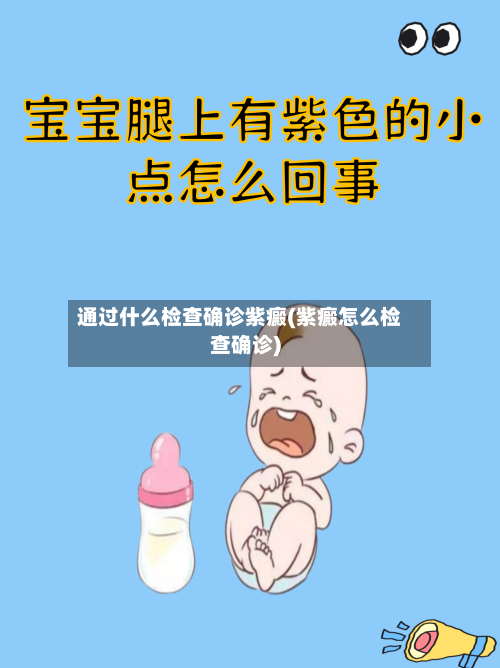 通过什么检查确诊紫癜(紫癜怎么检查确诊)