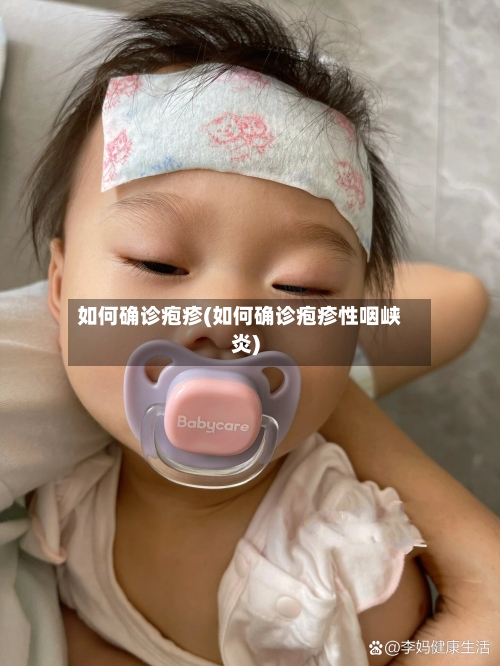 如何确诊疱疹(如何确诊疱疹性咽峡炎)