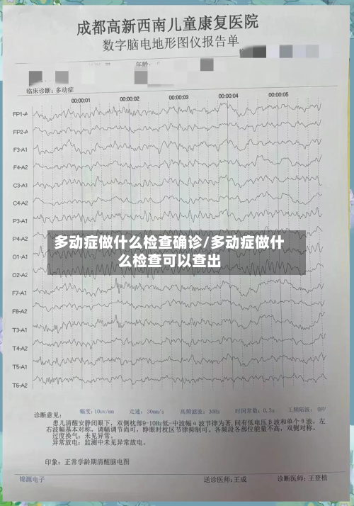 多动症做什么检查确诊/多动症做什么检查可以查出
