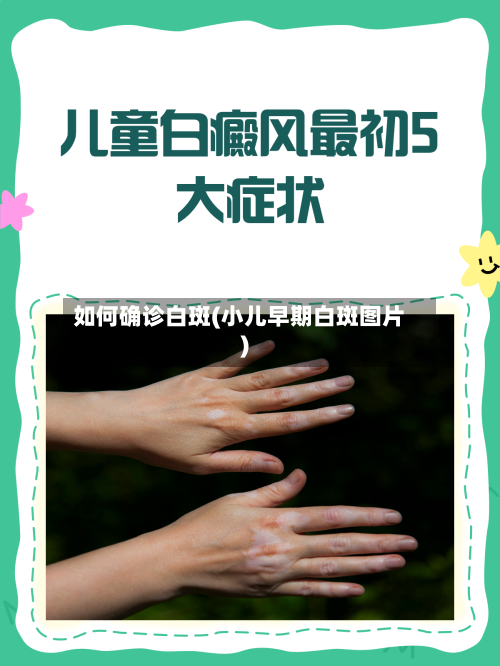 如何确诊白斑(小儿早期白斑图片)