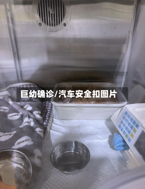 巨幼确诊/汽车安全扣图片