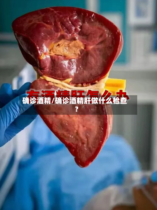 确诊酒精/确诊酒精肝做什么检查?